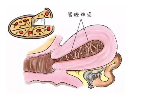 做試管費用價格