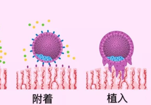 美國助孕試管生子？