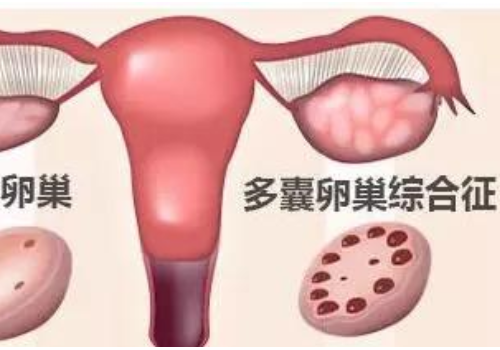 美國試管嬰兒費用？